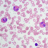 By Ed Uthman, MD, Houston, Texas, USA - Own work, CC BY 3.0, https://commons.wikimedia.org/w/index.php?curid=10813548