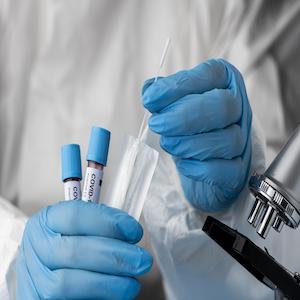 Immagine di <a href="https://it.freepik.com/foto-gratuito/medico-che-analizza-i-campioni-di-sangue-con-il-microscopio_13911976.htm#query=covid&position=30&from_view=search&track=sph">Freepik</a>