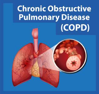 <a href="https://it.freepik.com/vettori-gratuito/science-education-of-human-anatomy-copd-infographic_62533419.htm#query=chronic%20obstructive%20pulmonary%20disease&position=10&from_view=search&track=ais">Immagine di brgfx</a> su Freepik